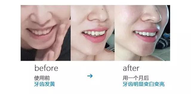 用了1年的健齿白,牙还这么黄,如何让我的笑容更有力量?
